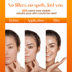 Dark Spot & Pigmentation Reduction Face Serum