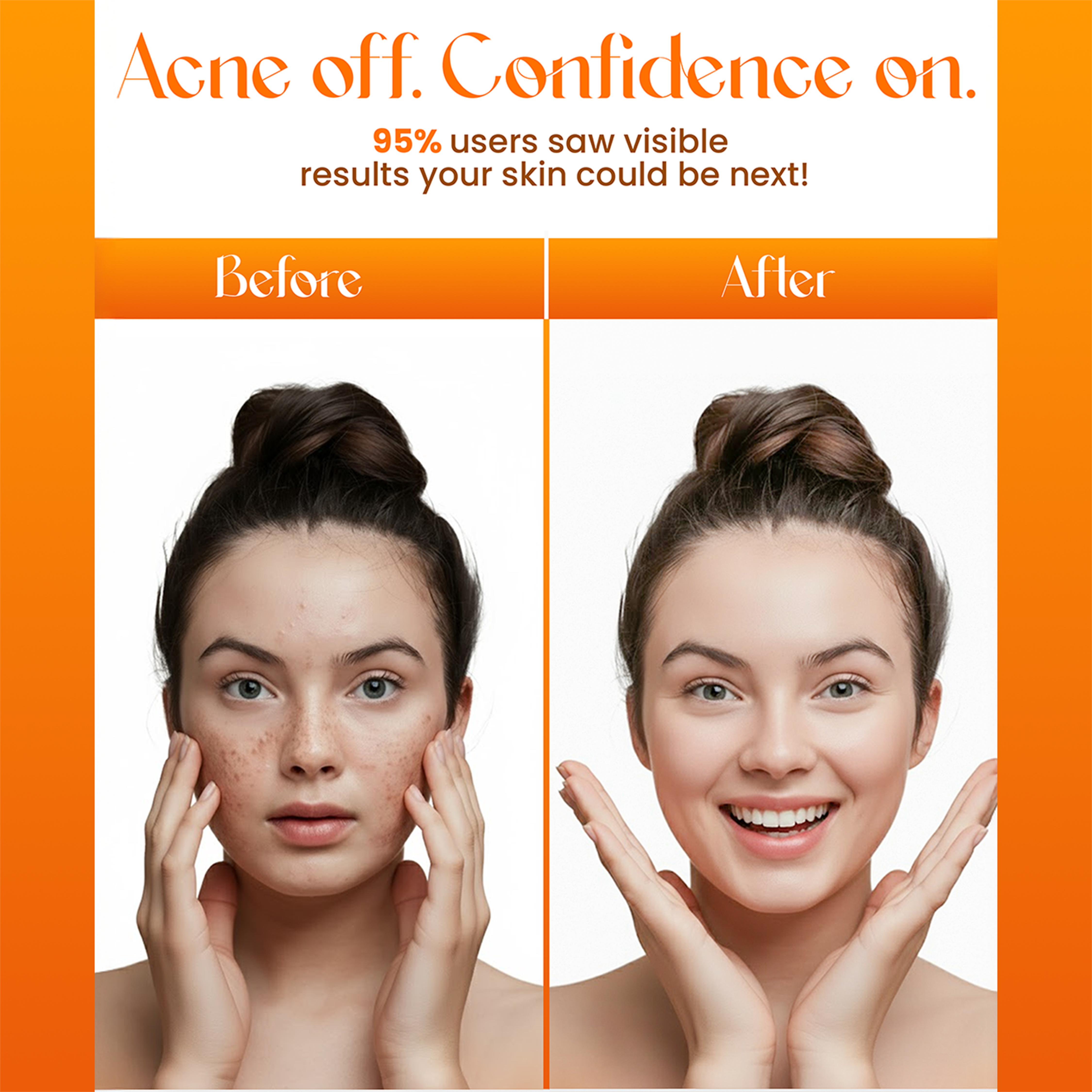 Acne Enemy Cooling Cleanser For Oily Skin