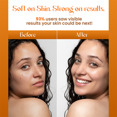 Ultra Hydrating & Brightening AHA/BHA Moisturizer