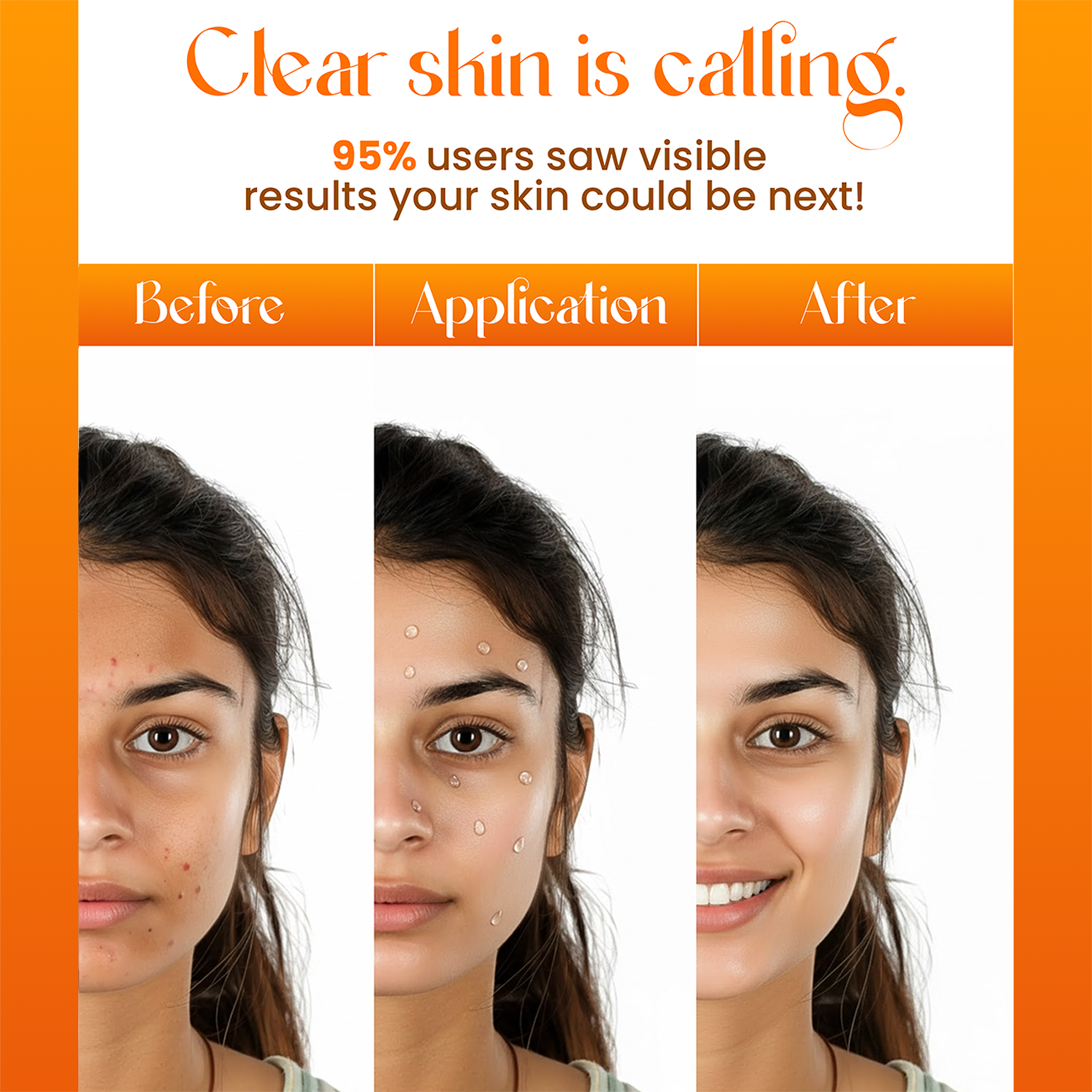 Acne Enemy Face Serum