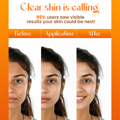 Acne Enemy Face Serum